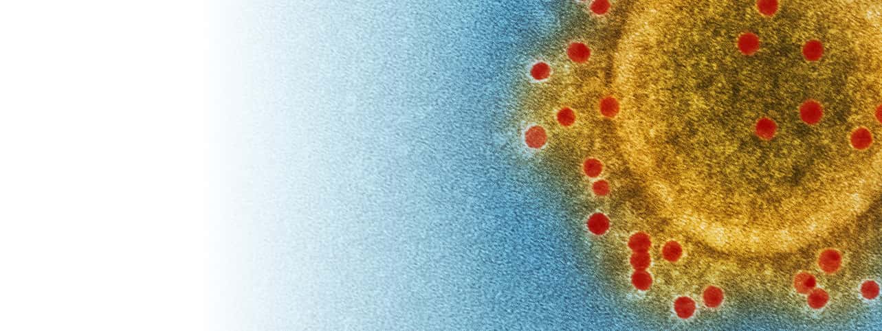 Coronavirus